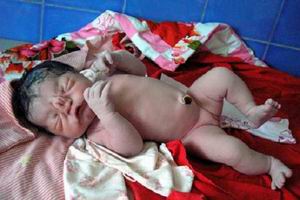 染色體畸變疾病