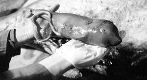 取出一隻已經死亡的小抹香鯨胎兒