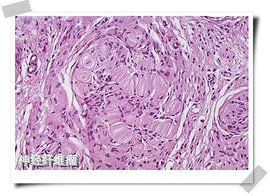 神經纖維 神經纖維