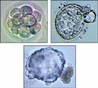 （圖）晶胚