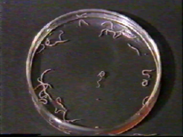 十二指腸鉤口線蟲 十二指腸鉤口線蟲