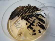 土生隱球菌 土生隱球菌