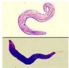 消化道傳染病 消化道傳染病