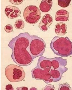 病態造血 病態造血