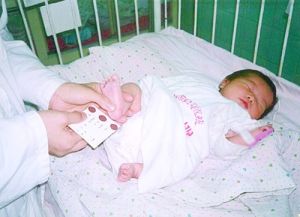 先天性甲狀腺功能低下