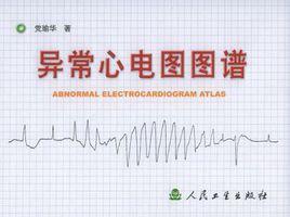 異常心電圖圖譜 異常心電圖圖譜
