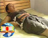 腰椎牽引器牽引治療