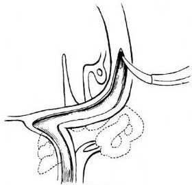 減壓神經 減壓神經