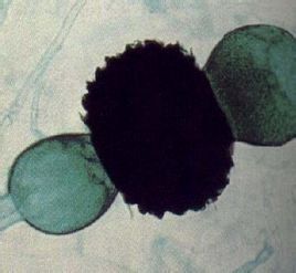 接合孢子 接合孢子