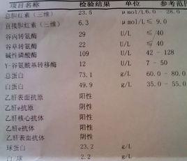 急性B肝 急性B肝