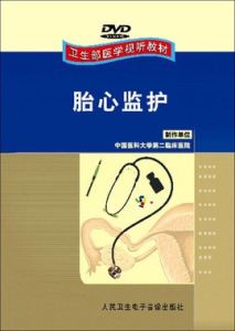 胎心監測 胎心監測