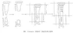 先天性脛骨假關節
