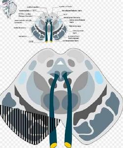 韋伯氏麻痹 韋伯氏麻痹