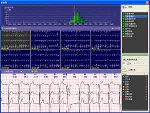 室性逸搏及室性逸搏心律
