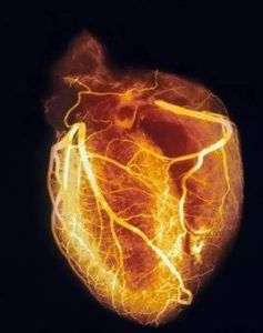 造影檢查 造影檢查