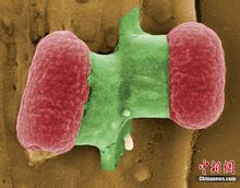 德國公布致命大腸桿菌顯微鏡下照片