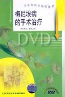 《梅尼埃病的手術治療》