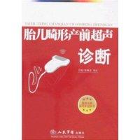 胎兒畸形產前超聲診斷 胎兒畸形產前超聲診斷