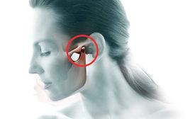 顳頜關節 顳頜關節