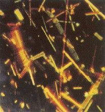 核黃素顯微照片 