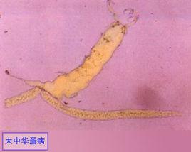 大中華蚤病 大中華蚤病