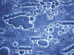 顯微鏡下的細菌