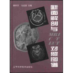 斷面解剖與MRI CT ECT對照圖譜