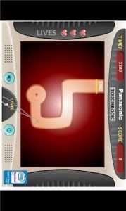 結石手術 結石手術