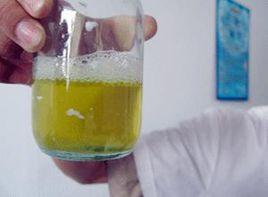 新生兒蛋白尿 新生兒蛋白尿