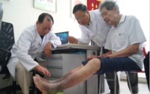 原發性下肢靜脈曲張 原發性下肢靜脈曲張