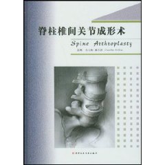 脊柱椎間關節成形術