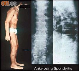 強直後超極化 強直後超極化