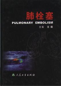 妊娠合併肺栓塞