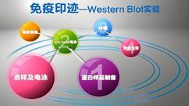 免疫印跡法 免疫印跡法