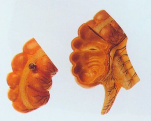 （圖）盲腸和闌尾模型