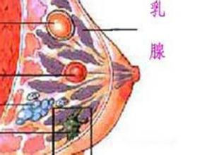 乳腺纖維肉瘤