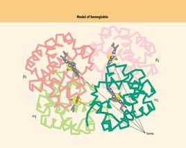 血色素病 血色素病