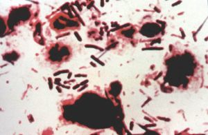 豬梭菌性腸炎病原