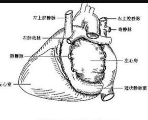 左側上腔靜脈永存 左側上腔靜脈永存