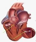 心肌解剖圖