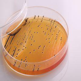 沙門菌屬 沙門菌屬