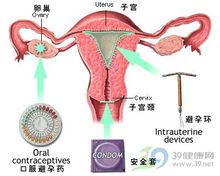 子宮避孕