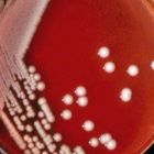 克雷伯氏菌單菌落形態