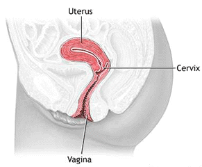 （圖）子宮與陰道