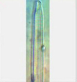 肘狀針桿藻 肘狀針桿藻