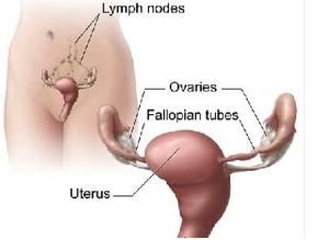 左側卵巢囊腫 左側卵巢囊腫