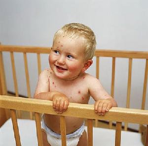 （圖）皮膚白血病