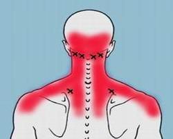 抗利尿激素分泌異常綜合徵