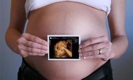 三維超聲 三維超聲