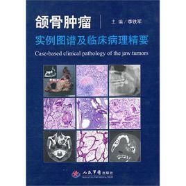 頜骨腫瘤實例圖譜及臨床病理精要 頜骨腫瘤實例圖譜及臨床病理精要